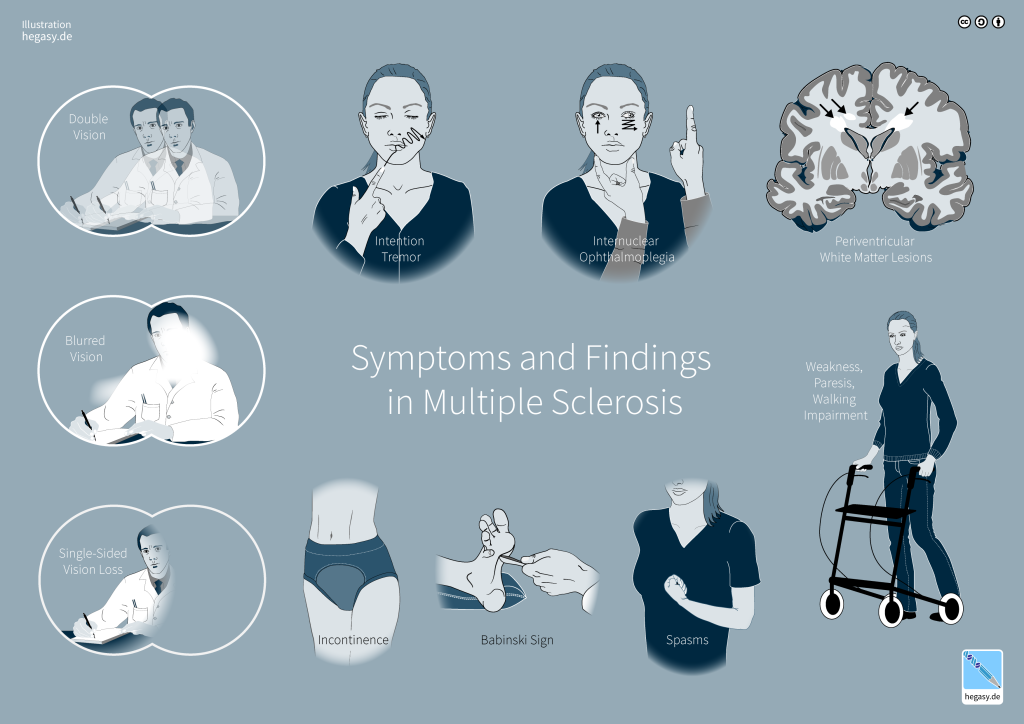 Infographic of symptoms in Multiple Sclerosis.