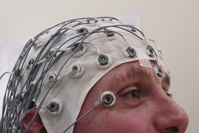Picture of an EEG recording cap.