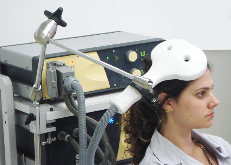 Photo showing a transcranial magnetic stimulation (TMS) coil positioned over a person’s scalp.