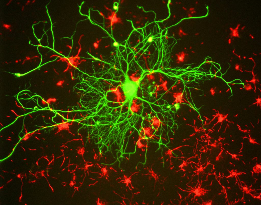 Image of cortical neuron stained with antibody to neurofilament subunit in green.