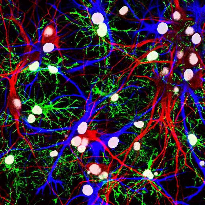 Image of blue and red of neurons branches leading to white bulbs of glia.