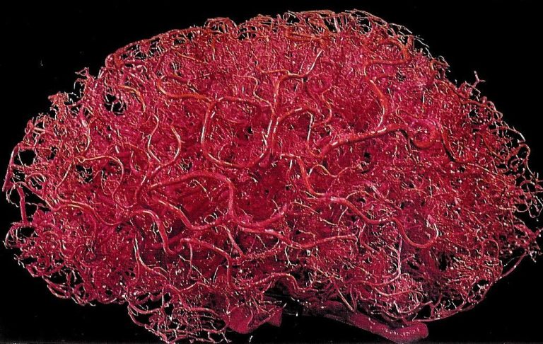 A cast of the brain’s vasculature.