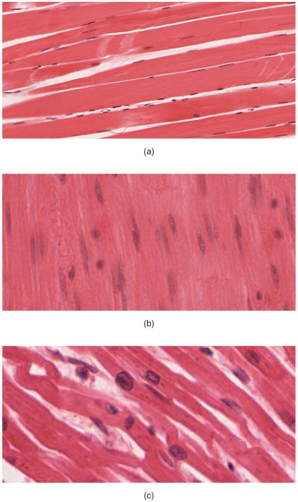 The image shows the striated appearance of cardiac muscle, with visible intercalated discs. This type of muscle is unique to the heart and facilitates rhythmic contractions.