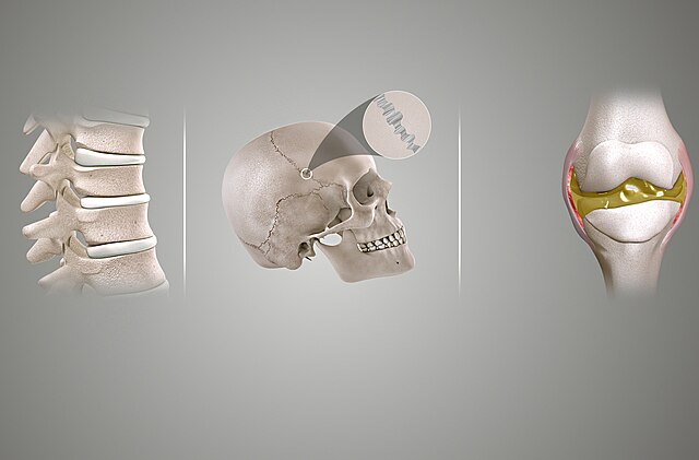 This image categorizes joints into three main types: fibrous, cartilaginous, and synovial joints. It highlights the anatomical differences between these joint types and provides examples of where each can be found in the body.