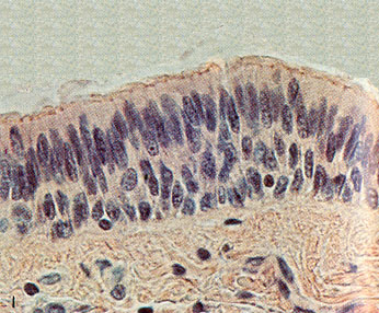 This image shows multiple layers of columnar cells stacked on top of one another. Stratified columnar epithelium is less common in the body, found in areas such as the male urethra and ducts of certain glands. The layers provide added protection in areas exposed to mechanical stress.