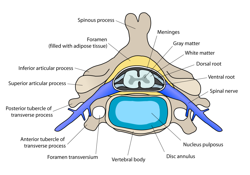 The image shows a single cervical vertebra, with labels for the vertebral body, spinous process, transverse processes, and the vertebral foramen (the space through which the spinal cord passes). The vertebra is shown in both anterior and lateral views.