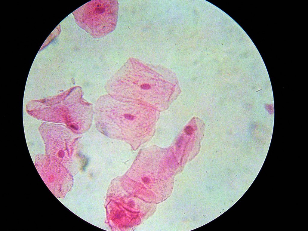 The image shows squamous epithelial cells from the lining of the mouth, stained pink for enhanced contrast under the microscope. The cells appear polygonal in shape with clearly visible nuclei. The staining highlights the cellular structure and makes it easier to observe features such as the cell membrane, cytoplasm, and nucleus.