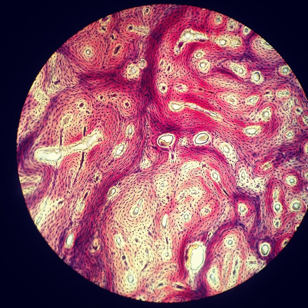 The image shows the dense structure of compact bone, with visible osteons (Haversian systems), which are circular units of bone tissue. Each osteon contains a central canal surrounded by concentric lamellae of bone tissue. The dark spots represent lacunae, which house bone cells (osteocytes).