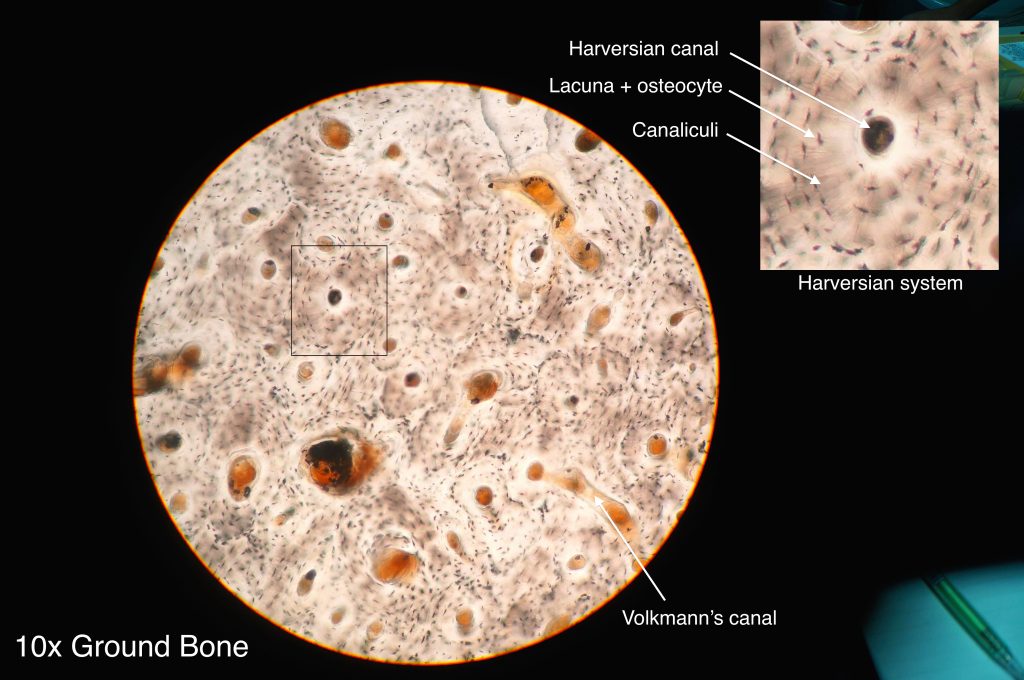 The image shows the typical arrangement of osteons in compact bone. Each osteon surrounds a central canal (Haversian canal), which contains blood vessels and nerves. The concentric layers of bone tissue are called lamellae, and small dark spaces (lacunae) contain osteocytes.