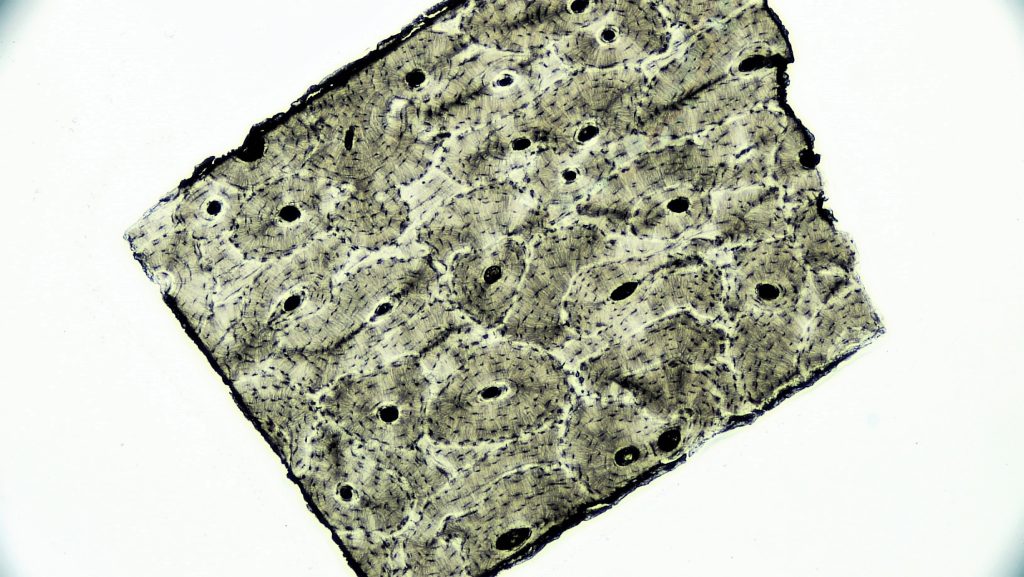 The image shows the dense, organized structure of compact bone, including Haversian systems and osteocytes.