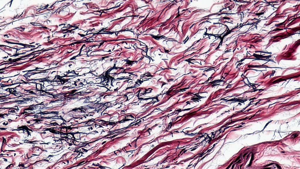 The image shows densely packed elastic fibers, which provide flexibility and strength to tissues such as ligaments and arteries. The fibers are wavy and appear in bundles, enabling the tissue to stretch and recoil.