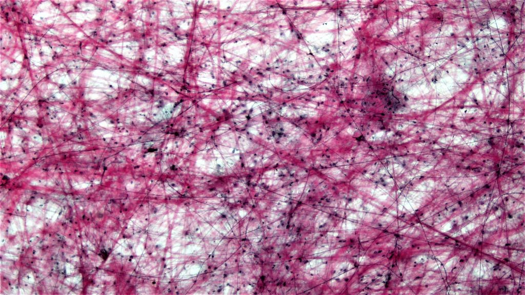 The image shows a loose arrangement of fibers and cells, providing support and flexibility to the tissues and organs.