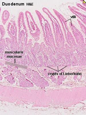 Small intestine mucosa showing the intestinal villi and crypts of Lieberküh, low magnification.