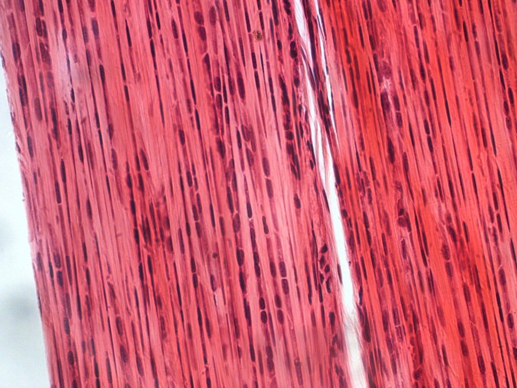 This image displays tightly packed collagen fibers, arranged in parallel bundles. Fibroblasts, the cells that produce collagen, are visible between the fibers. Dense connective tissue is found in tendons and ligaments, where its strength and resistance to stretching are critical.