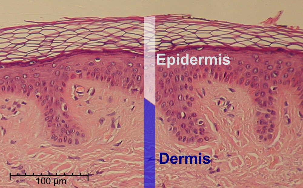 The image clearly marks the boundary between the upper epidermal layer and the lower dermal layer, visually differentiating the two.