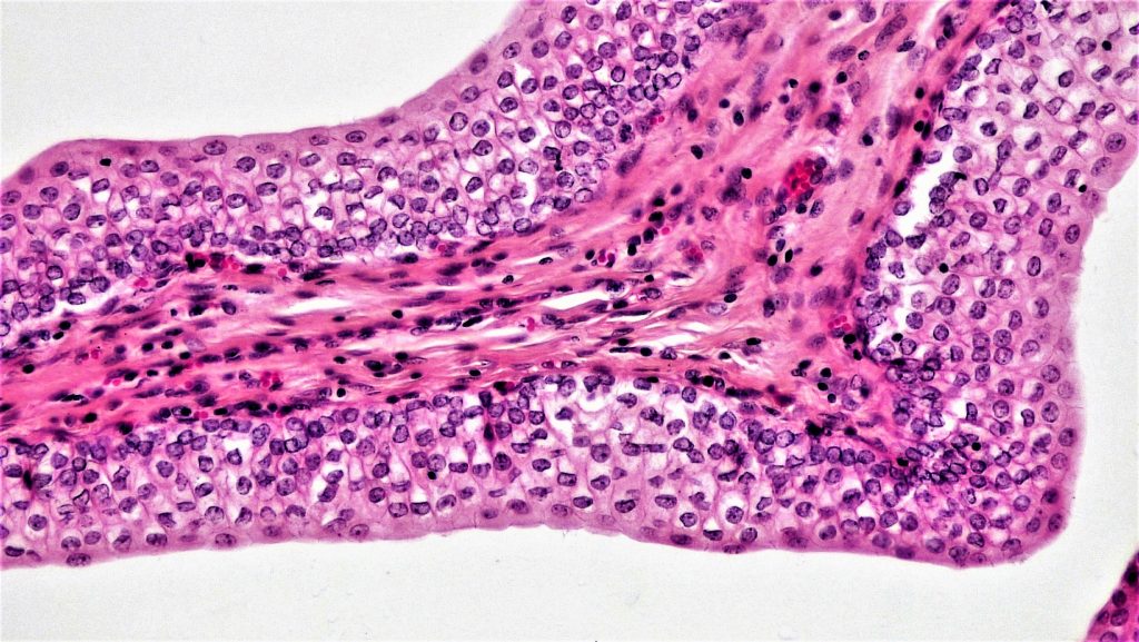 The image shows transitional epithelium, which consists of multiple layers of cells that can stretch and change shape. This type of tissue is typically found in the urinary system (urinary bladder and ureters) and other structures that expand and contract. The cells at the surface appear rounded when the tissue is relaxed and become flattened when stretched.