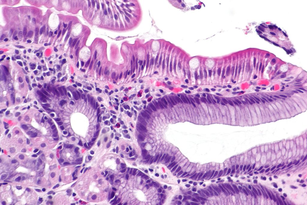 This image shows the inner layer of the duodenum composed of simple columnar epithelium with Goblet cells.