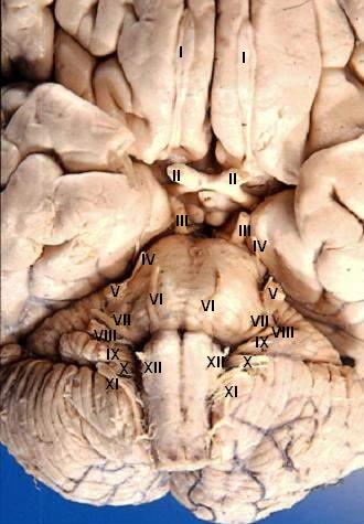 This image shows the human brain from the front and bottom, revealing key structures such as the frontal lobes, olfactory bulbs, and optic nerves. The brainstem and cerebellum are visible from this inferior perspective.