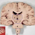 Human brain frontal (coronal) section.