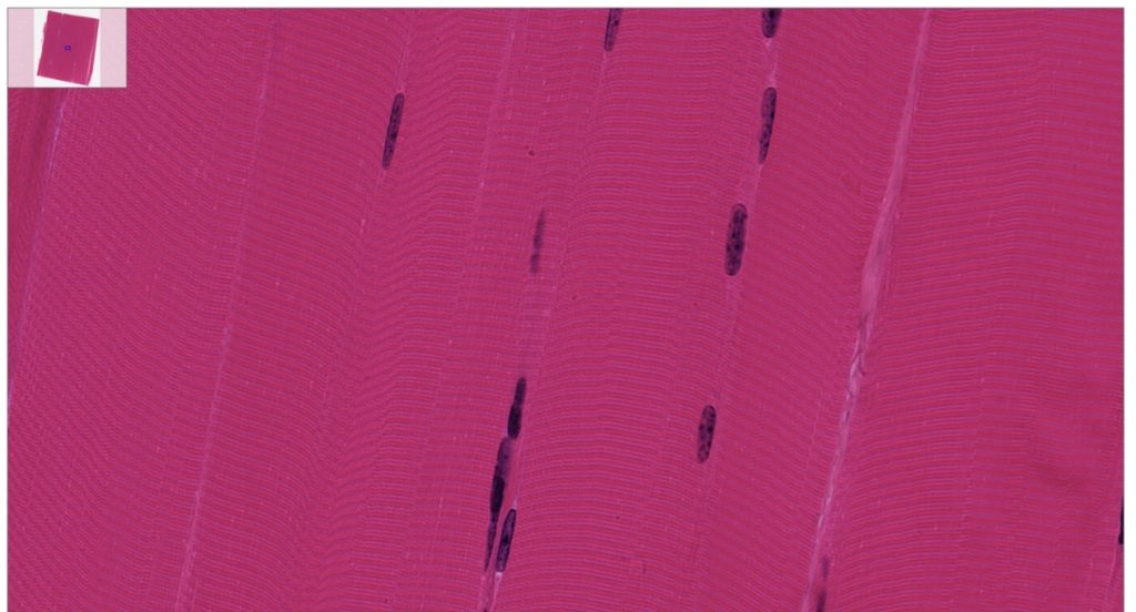 The image reveals the striated appearance of skeletal muscle fibers, which are long and cylindrical.