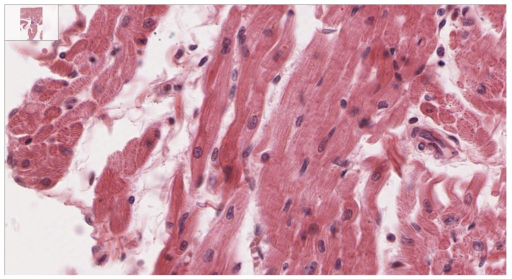 This image shows the branching structure of cardiac muscle fibers, including the visible striations (light and dark bands), intercalated discs (junctions between cells) and central nucleus. These cells are unique to the heart and are responsible for its ability to contract rhythmically and efficiently.