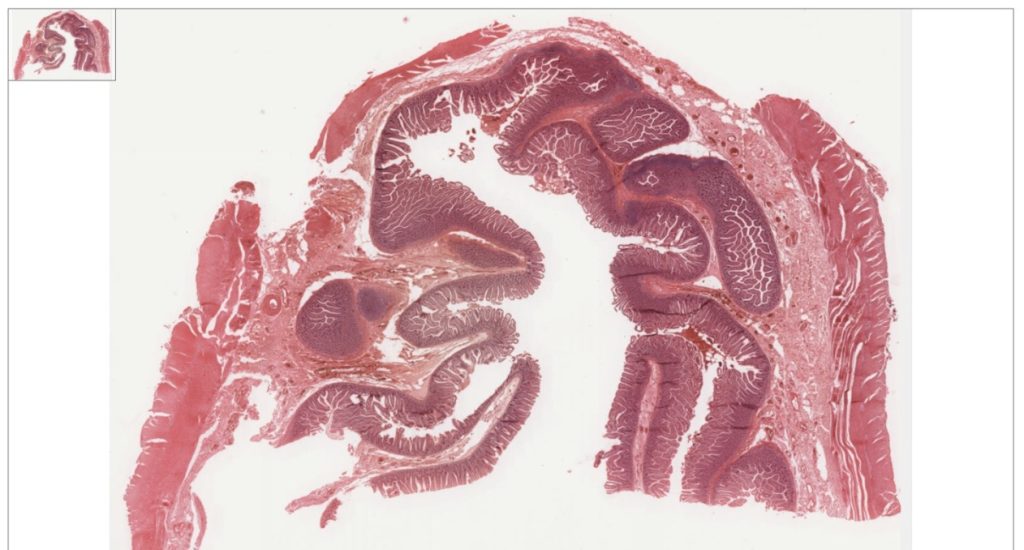 This image highlights the non-striated appearance of smooth muscle fibers, showing the spindle-shaped cells that make up smooth muscle. The tissue is found in structures like blood vessels, the digestive tract, and other organs that require involuntary movement.