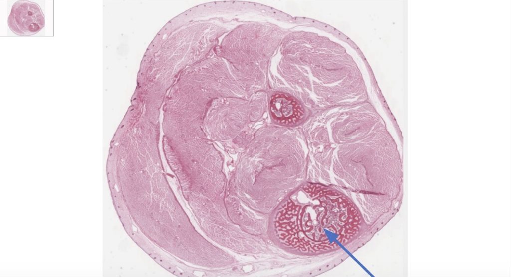 The image shows spongy bone and its trabecular network, with labels pointing to key features like the marrow-filled spaces and bony trabeculae.