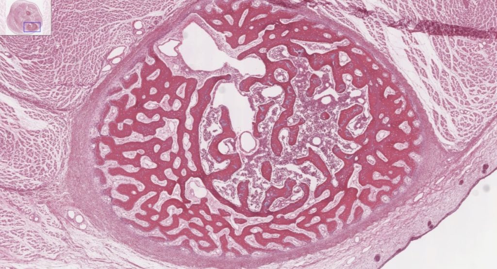 The image offers a detailed view of the trabeculae in spongy bone, highlighting the porous network that characterizes this bone type.