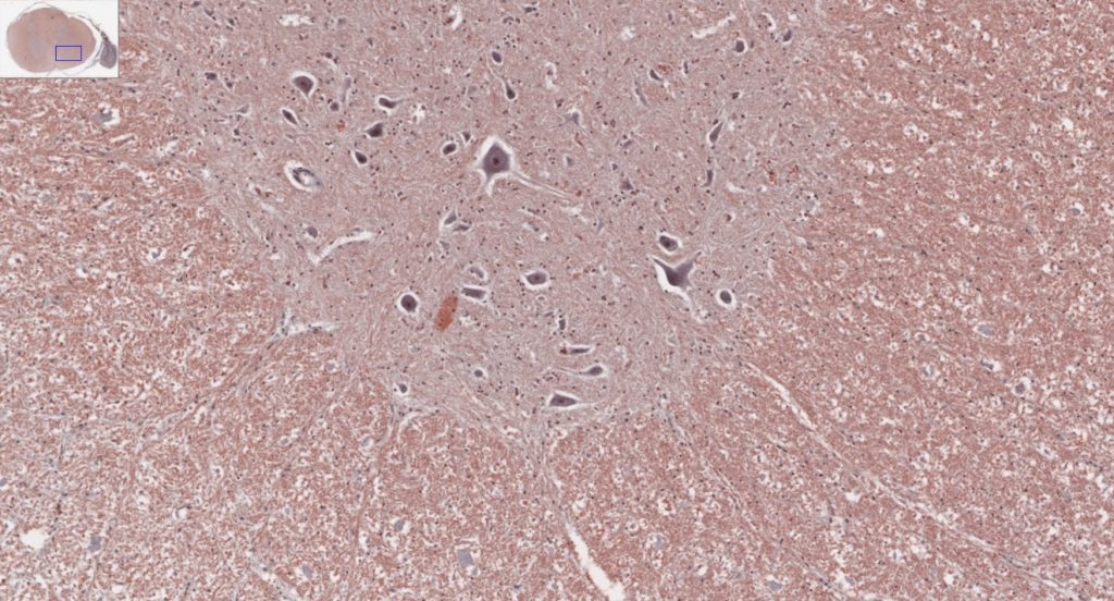 This image highlights the sensory neurons located in the dorsal root ganglion and shows their connection to the spinal cord. The image provides details on the pathways used to transmit sensory information to the central nervous system.