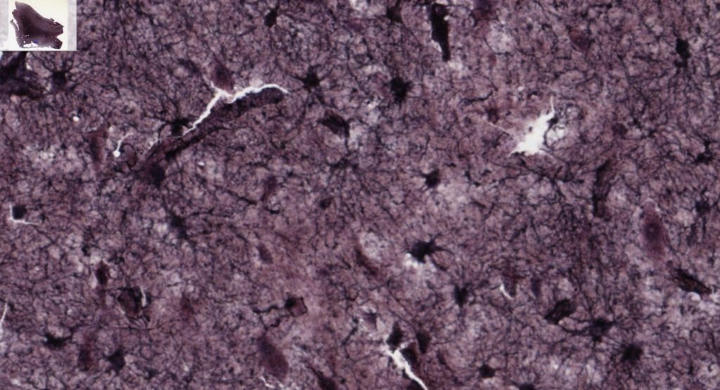 Astrocytes, star-shaped cells, are shown in this microscopic image. These cells play a key role in supporting neurons, maintaining the blood-brain barrier, and regulating the chemical environment in the brain. Their branching structures can be seen forming a network throughout the brain tissue.