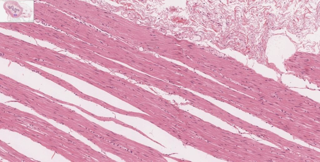 The image shows the unique structure of cardiac muscle, with intercalated discs and striations visible. These features are responsible for the rhythmic contraction of heart muscle, ensuring effective blood circulation.