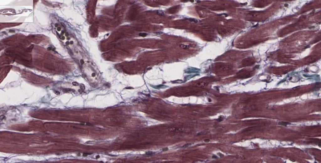 The image depicts the heart and major blood vessels in the human body. Arteries, veins, and capillaries are labeled, showing how blood circulates through the systemic and pulmonary circuits. The heart is shown in detail, with labels for the chambers and valves that control blood flow.