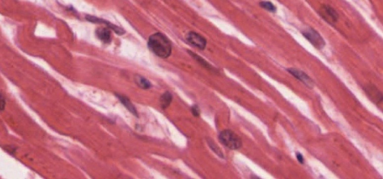 The image shows the striated appearance of cardiac muscle, with visible intercalated discs. This type of muscle is unique to the heart and facilitates rhythmic contractions.