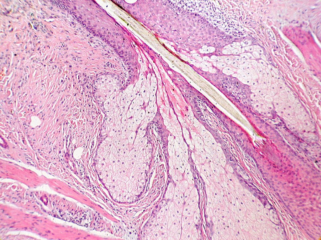 The image highlights sebaceous glands connecting to the hair shaft, releasing sebum to lubricate the hair and skin.