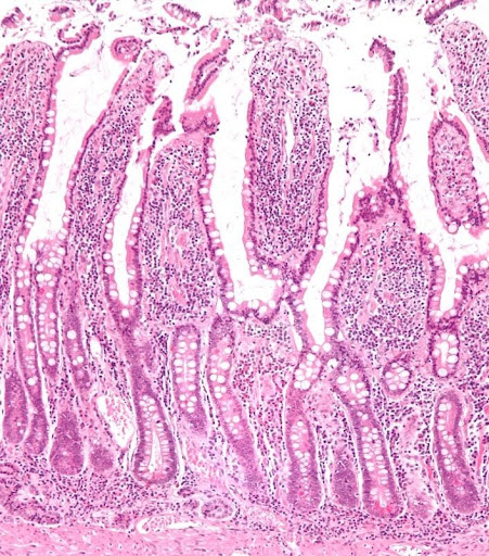 This image shows invaginations of the intestinal epithelium, called crypts of Lieberkuhn, which are responsible for secreting digestive enzymes and producing new epithelial cells. The crypts are surrounded by villi, which increase the surface area for nutrient absorption.