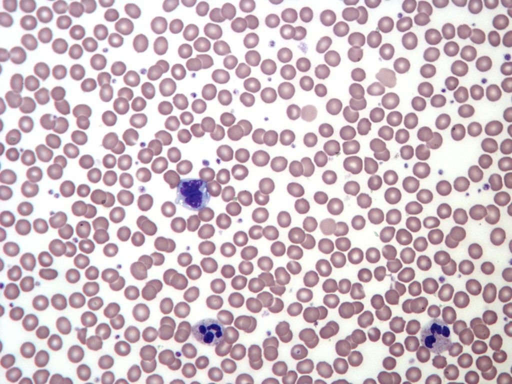 This image shows various types of blood cells, including red blood cells (erythrocytes, which transport oxygen), white blood cells (leukocytes, which are involved in immune response), and platelets (small cell fragments important for blood clotting). Red blood cells appear as small, round cells, while white blood cells and platelets are larger and less numerous.