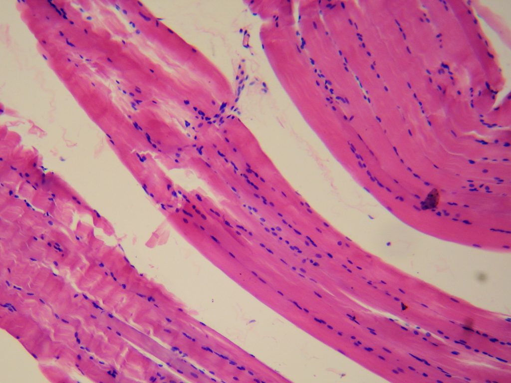 The image displays smooth muscle cells, characterized by spindle-shaped cells and no visible striations.