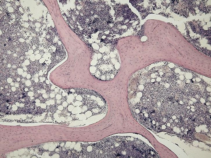 The image highlights the thin, web-like trabeculae found in spongy bone, which form a porous network. The trabeculae surround marrow spaces.