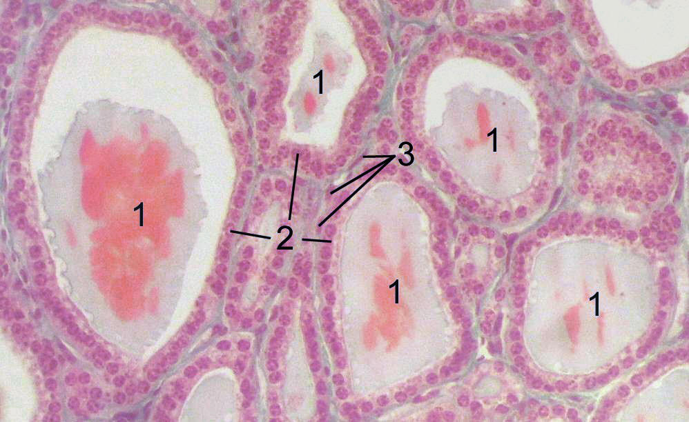 The image shows the follicles within the thyroid, which store thyroid hormones, surrounded by epithelial cells.