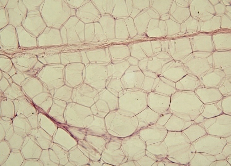 The image highlights large, empty-looking cells, which are fat cells where lipids have been washed out during the paraffin embedding process.