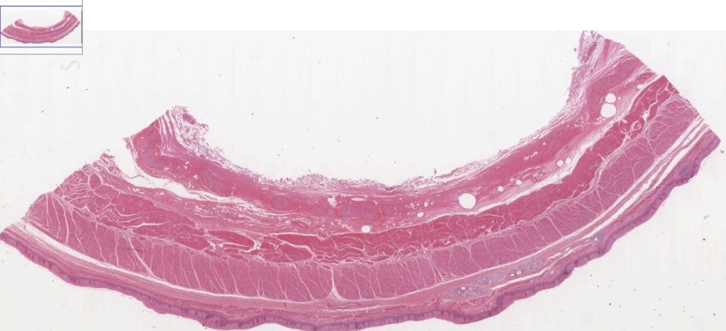 The image shows the non-keratinized stratified squamous epithelium of the esophagus, along with the underlying connective tissue layers. Hematoxylin stains the nuclei of the cells dark purple, while eosin stains the cytoplasm and extracellular matrix pink. The tissue is organized into distinct layers, with the epithelial lining at the top.