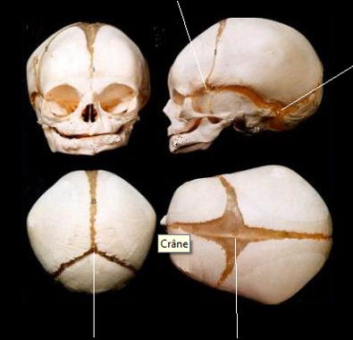 Human skull from four different views