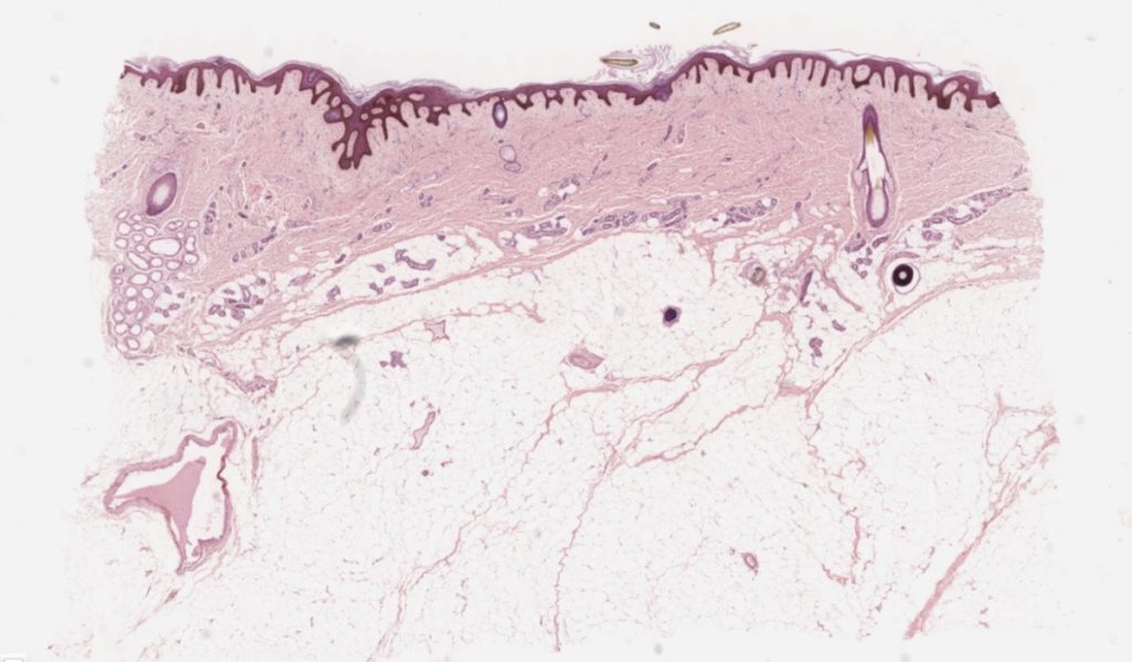 Thin skin, H&E, 40X (104-2)