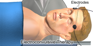 Image showing a guy with electrodes attached to his head. Details in text and caption