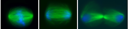 Fluorescent micrographs of cells in mitosis. DNA is stained in blue and microtubules in green. Metaphase is on the left, with blue chromosomes arranged in the middle. Anaphase is in the middle, with blue chromosomes pulled to opposite poles of the cell. Telophase and cytokinesis are shown on the right, with the pinching off of the cytosol visible from the clustering of microtubule fibers in the center of the cell.