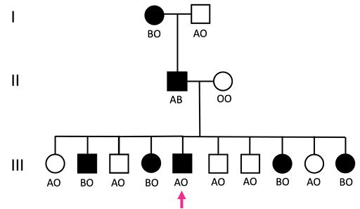 Pedigree tracking blood type and Nail Patella Syndrome through three generations.