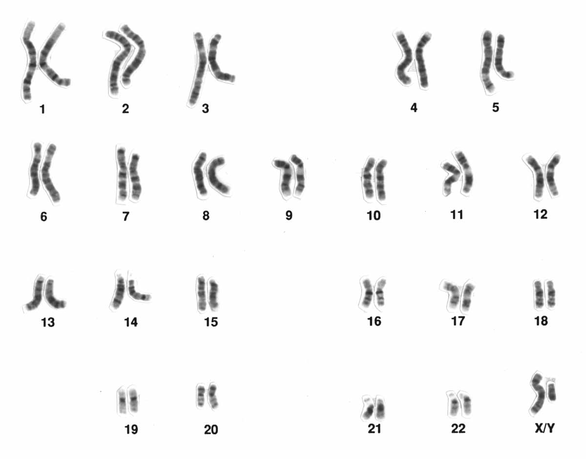 Giemsa banded karyogram of a typical human male karyotype.