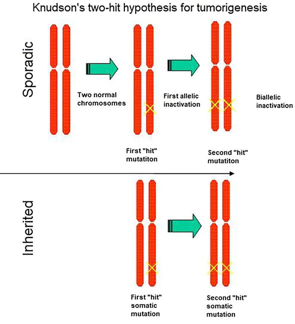 Sporadic cancer requires two successive mutations, one in each allele of a tumor suppressor. Inherited cancers begin with a germline mutation in one copy of a tumor suppressor, so only one additional mutation is needed.