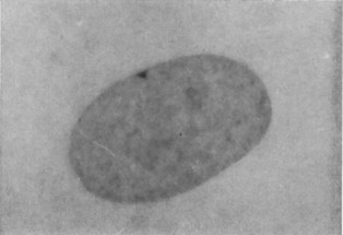 A cell nucleus with Barr body visible, indicated by an arrow.
