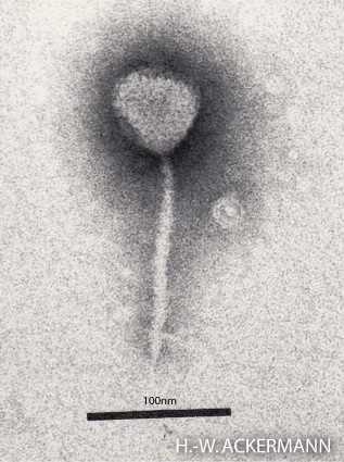 Electron micrograph of bacteriophage lambda.